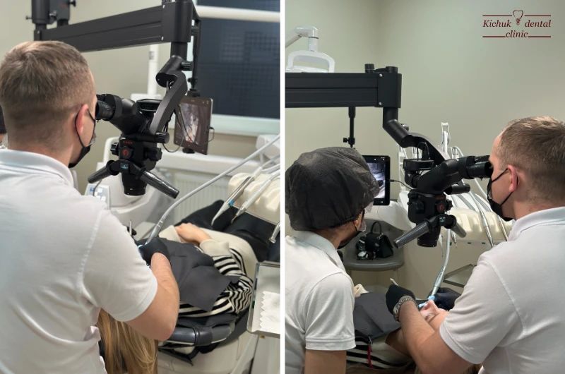 Лечения кариеса под микроскопом в стоматологии «Kichuk Dental Clinic» Одесса